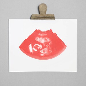 WATERMELON Ultrasound, Sonogram, Physical Print