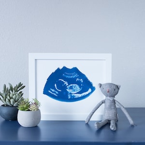 Ultrasound, Sonogram, ORIGINAL Cyanotype Print 8x10
