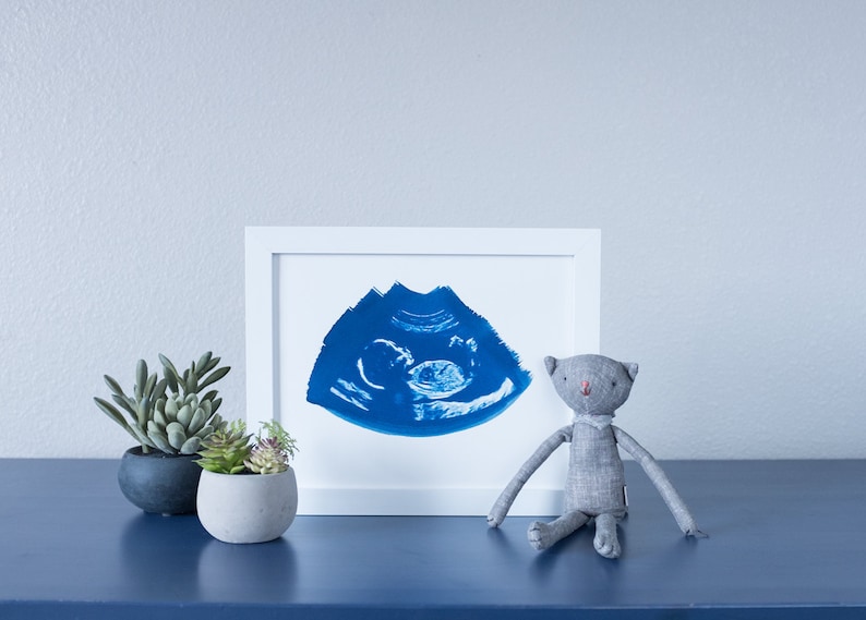 Ultrasound, Sonogram, ORIGINAL Cyanotype Print 8x10 image 1