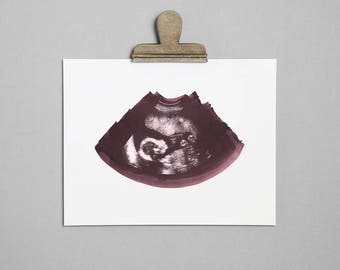 PLUM Ultrasound, Sonogram, Physical Print