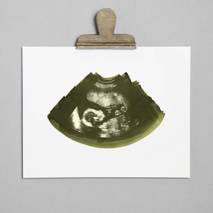 MOSS Ultrasound, Sonogram, Physical Print
