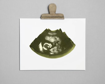 MOSS Ultrasound, Sonogram, Physical Print