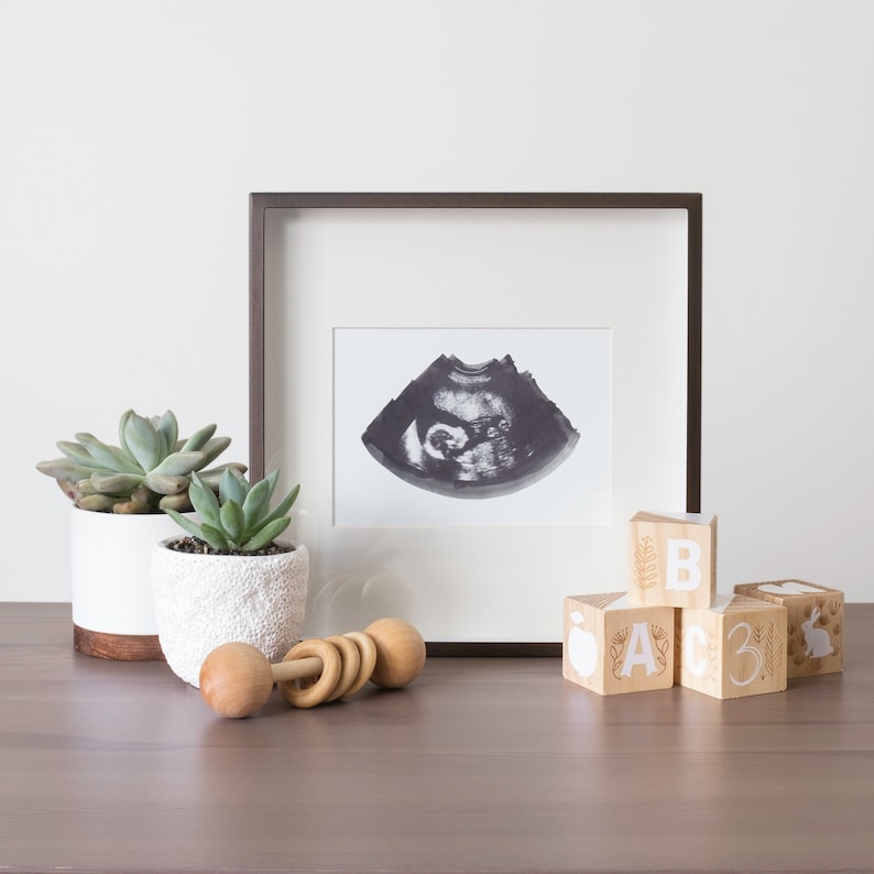 SLATE Ultrasound, Sonogram, Physical Print image 4