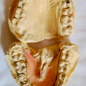 Vintage Cast Dental Teeth Impression Mold Tooth Castings 2 1/2&quot; Wide