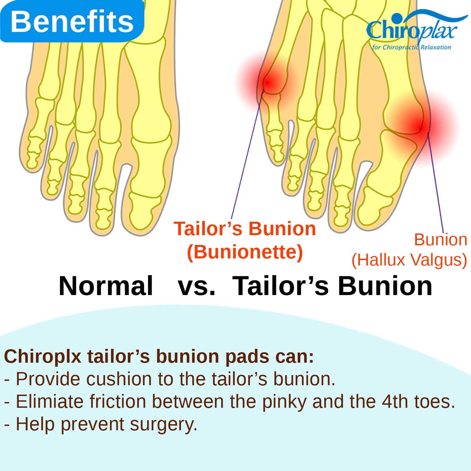 Chiroplax Tailor's Bunion Corrector Pads Pain Relief Pinky