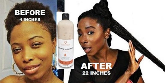 FERMENTED RICE non suds shampoo | Hair Growth Solution | Fast Grow Hair Shampoo
