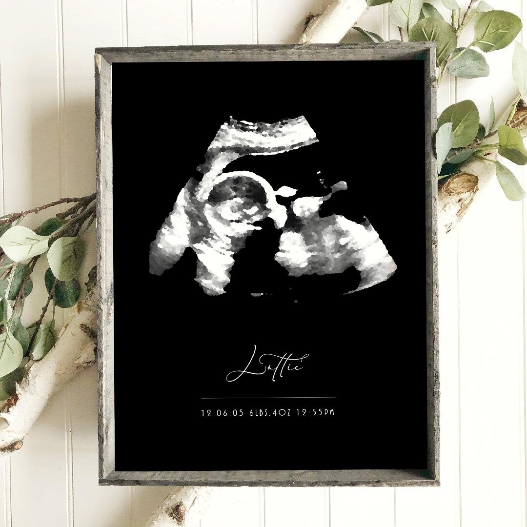 Custom Ultrasound Art Gallery Style Print Etsy