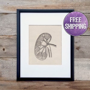 Kidney Anatomy Art On Canvas - Anatomy Wall Art For Home Or Meddical Office - Kidney Gifts - Kidney Transplant Gift -Kidney Print