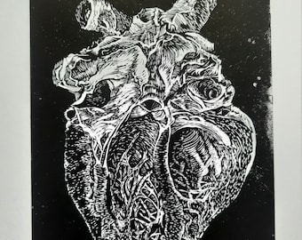Heart - cross section