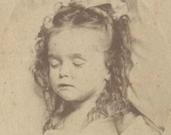 Postmortem CDV Photo Of Young Girl With Curly Hair//Sleeping Child//Forgotten History