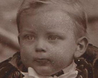 Vintage Cabinet Card Portrait Of Toddler In Striped Dress, Two Views, Early