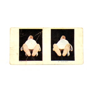 Vintage Stereograph Print of Sleeping Man With Large Feet