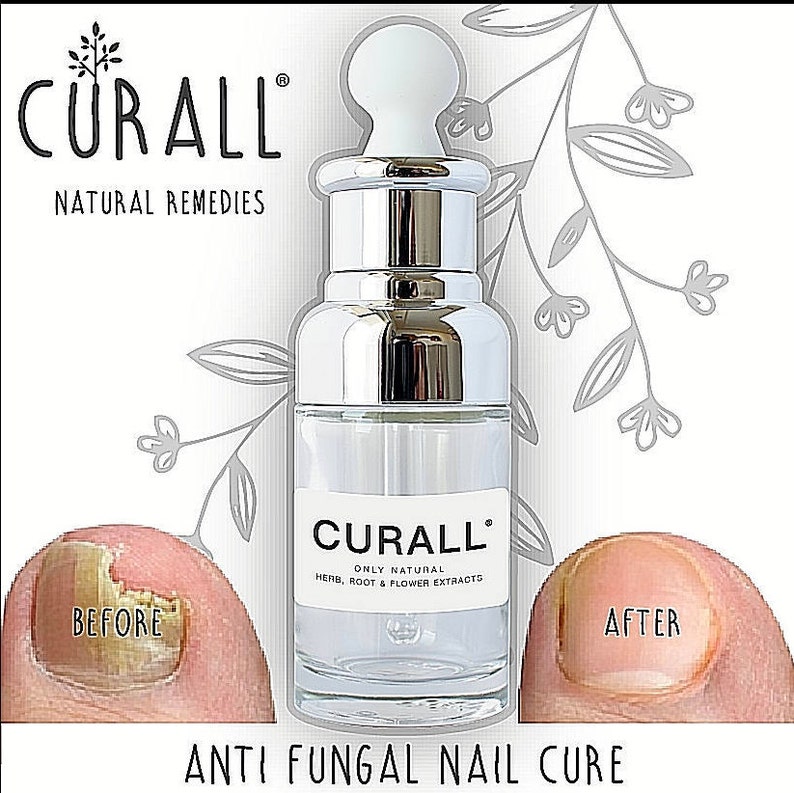 Fungal Nail Treatment. the Original Curall Best Selling Anti Etsy
