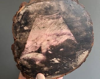 Aanpasbare echografie hout segment | Foto Transfer | Teken van hout | Echografie