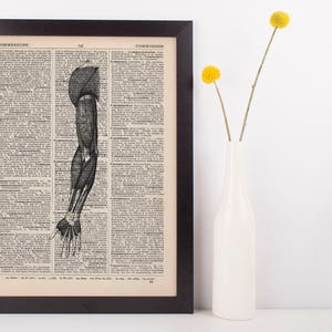 May include: A vintage anatomical illustration of the human arm muscles printed on a black and white page. The image is framed in a black frame and displayed against a white wall.