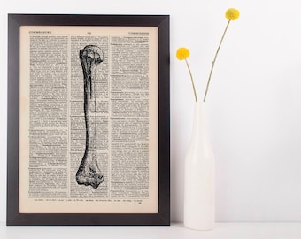 Anatomical Femur Leg Bone Dictionary Art Print, Medical Anatomy Vintage