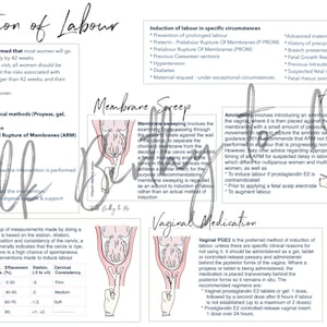Methods of IOL