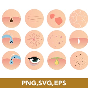 May include: Illustration of 12 different skin conditions, including wrinkles, acne, rosacea, and dry skin. Each condition is depicted in a circle with a light pink background.