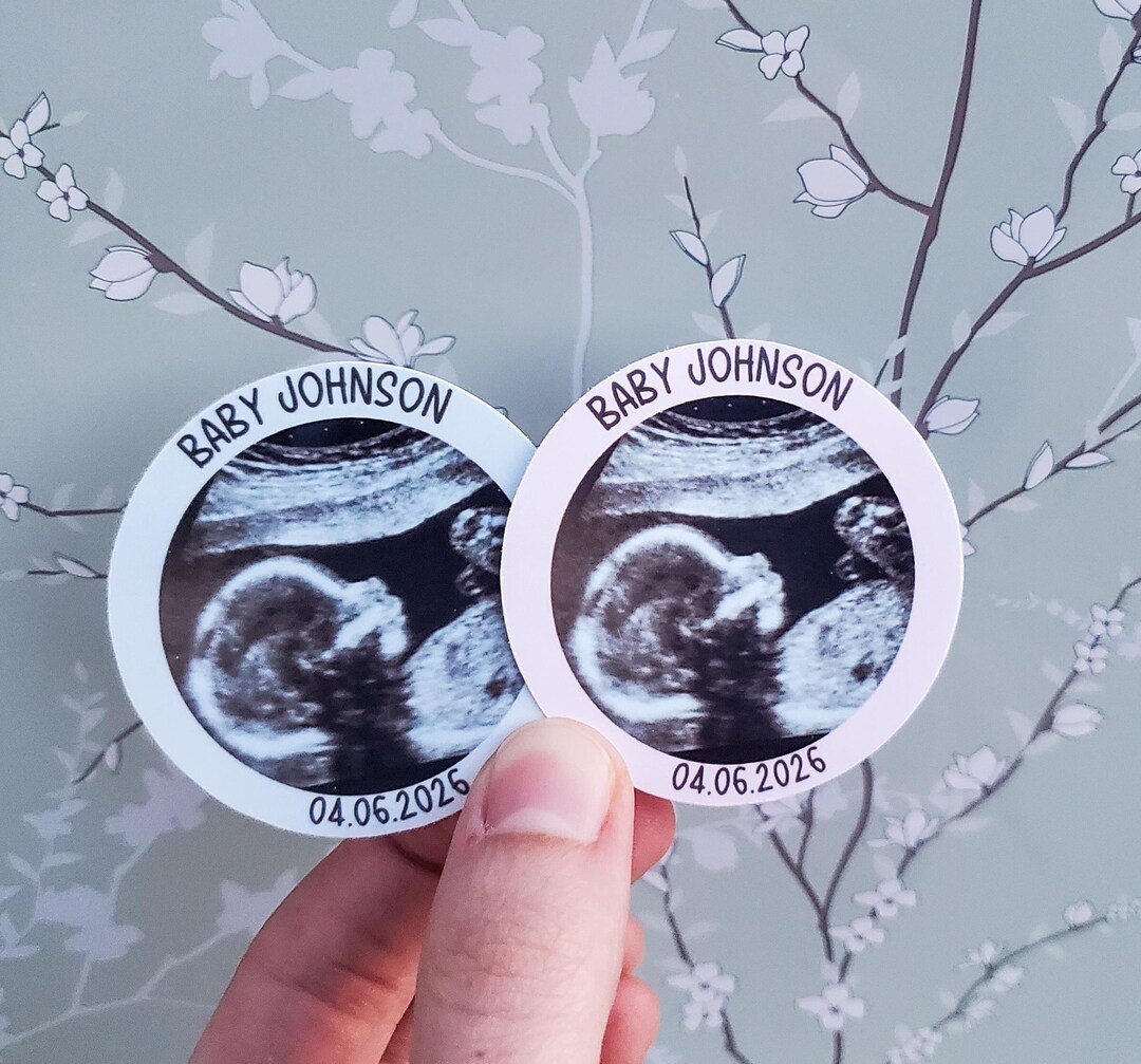Ultrasound Baby Shower Favor Stickers/ Thank You Labels Baby Shower ...
