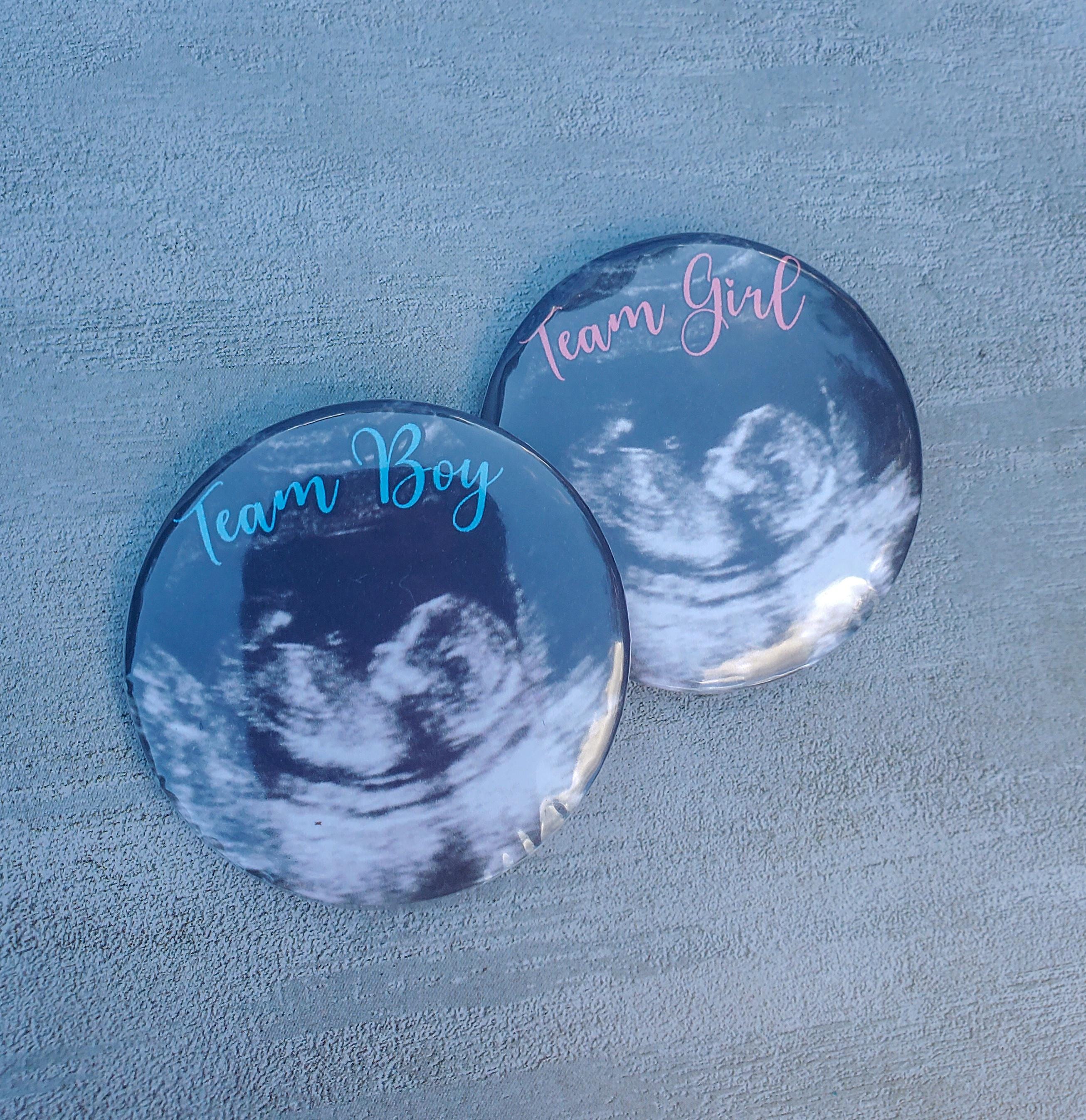 Custom Ultrasound Gender Reveal Buttons: Team Boy, Team Girl - Etsy