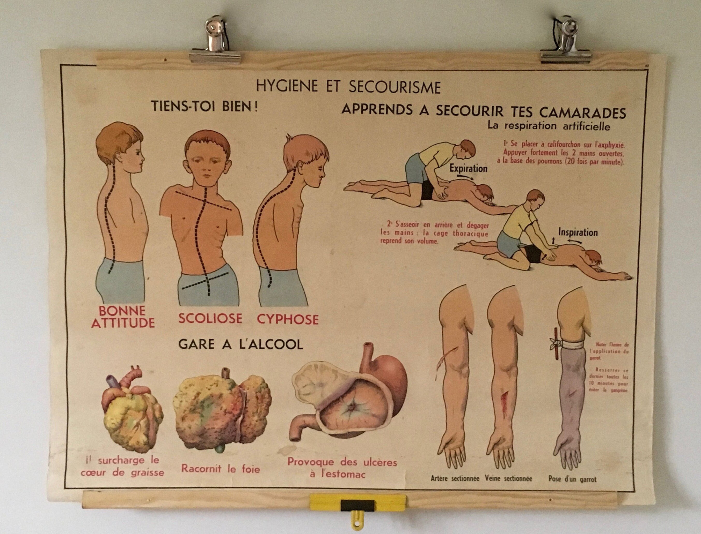 Carte Murale Ancienne École Anatomie Secourisme France French Vintage School Wall Map