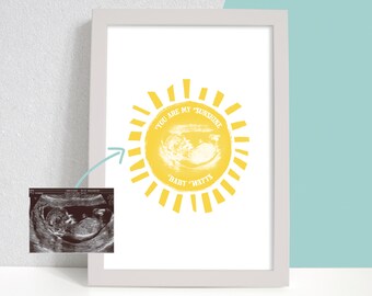 Personalised Baby Scan Sun Print Gift