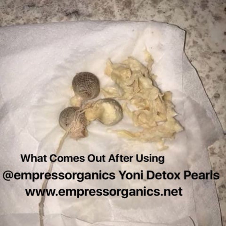 Yoni Detox Pearls Etsy