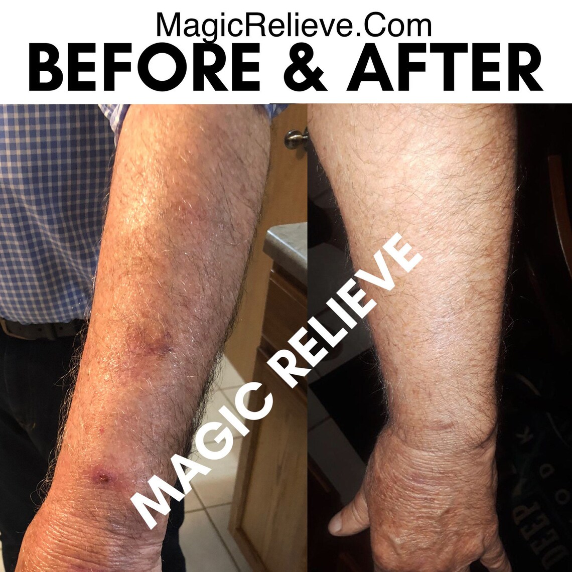 Relieve Eczema & Heals Irritated Sun Damage Itchy Skin Etsy