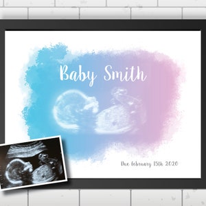 Baby ultrasound art print, baby scan watercolour print, pregnancy gift, ultrasound keepsake, sonogram photo picture, any colour scheme