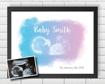 Baby ultrasound art print, baby scan watercolour print, pregnancy gift, ultrasound keepsake, sonogram photo picture, any colour scheme