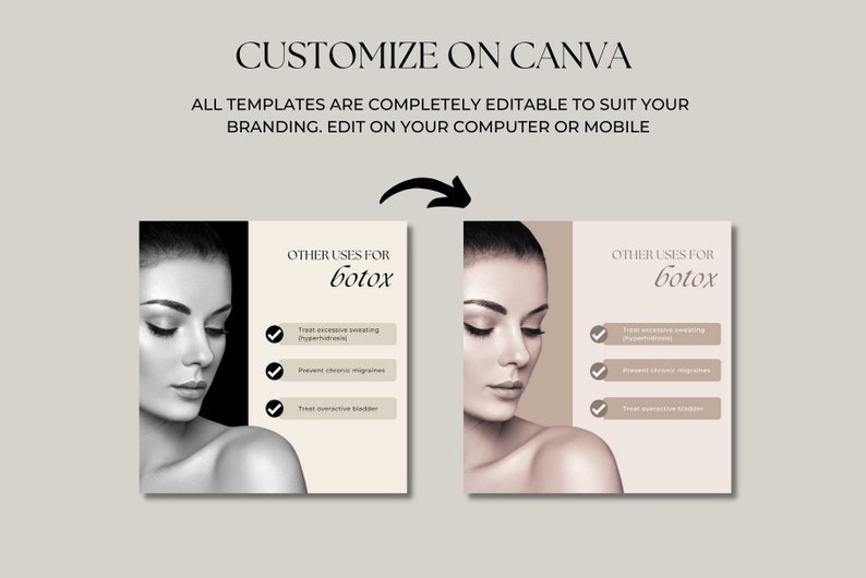 Botox and Filler Instagram Posts Canva Instagram Templates Etsy