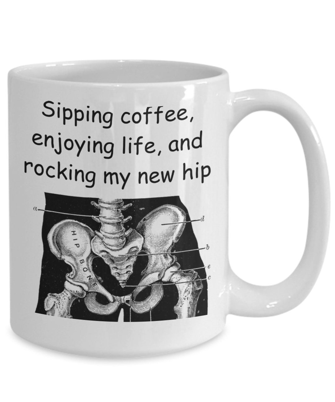 Hip Replacement Mug, New Hip Joint, Surgery Success, Recovery Gift Etsy