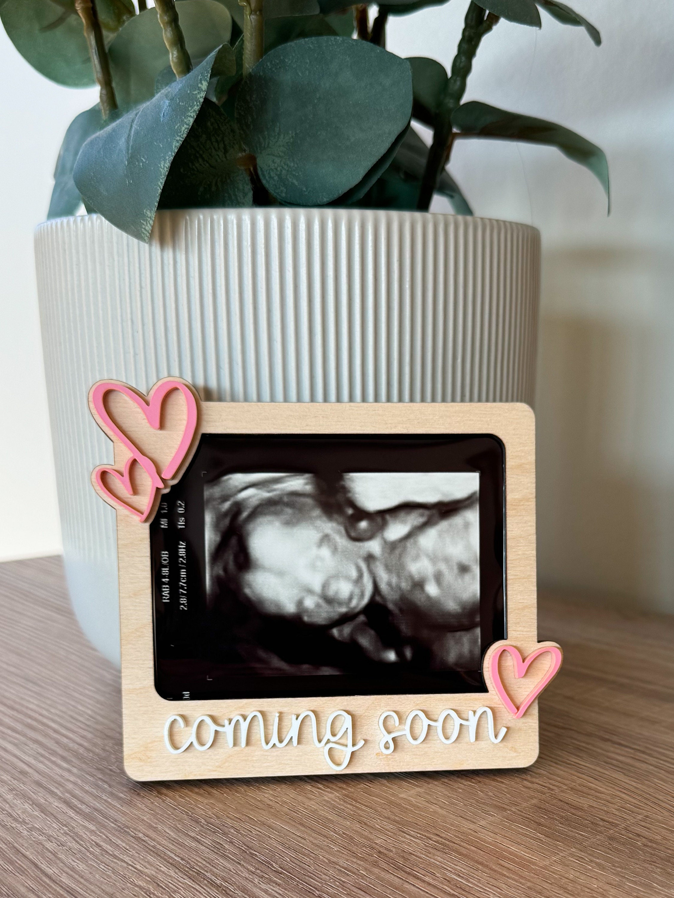 Sonogram Magnets Ultrasound Fridge Magnet, Ultrasound Picture Frame, Ultrasound Magnet ...
