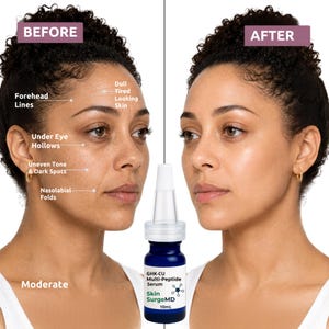May include: A split image shows a woman's face before and after using a skincare product. The "Before" side highlights forehead lines, uneven skin tone, and dark spots. A blue bottle of GHK-CU Multi-Peptide Serum is in the center. The "After" side shows improved skin.