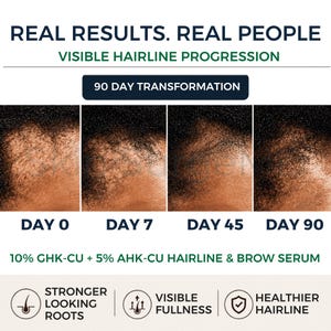 ahk cu results How Long Does AHK-Cu Take to Work? CU de 4800 mg favorece el crecimiento capilar Ahk Cu - Etsy