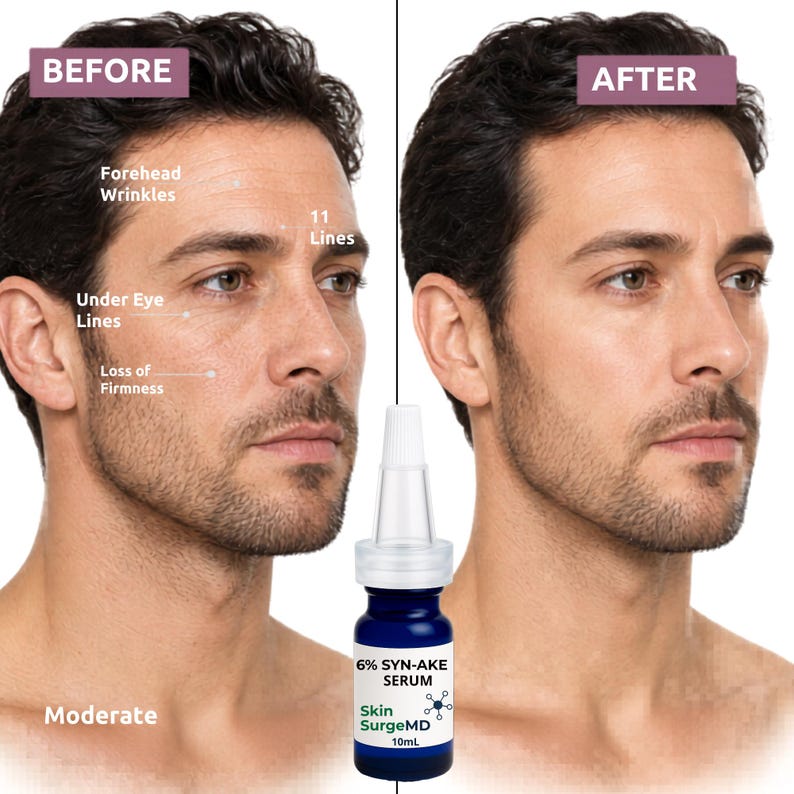 Op de afbeelding: Afbeelding die het gezicht van een man vergelijkt voor en na gebruik van een serum. De "Voor"-kant toont rimpels en verlies van stevigheid. De "Na"-kant toont een gladdere teint. Een blauwe fles "6% SYN-AKE SERUM" staat op de voorgrond.
