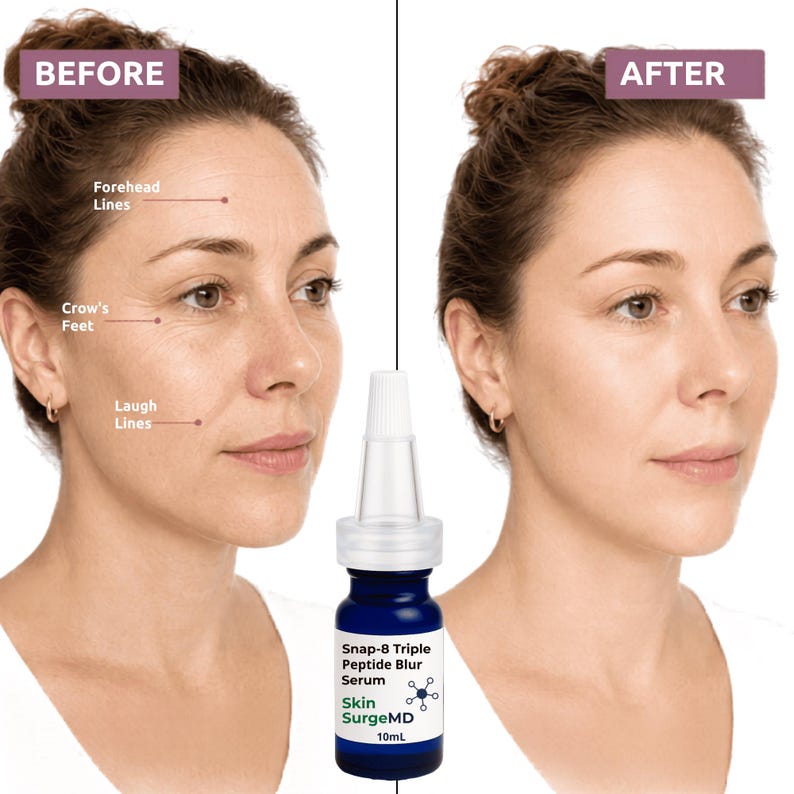 May include: A 10mL blue glass bottle of Skin SurgeMD Snap-8 Triple Peptide Blur Serum with a white dropper cap, displayed between two side-by-side facial portraits labeled Before and After, highlighting the reduction of forehead and laugh lines.