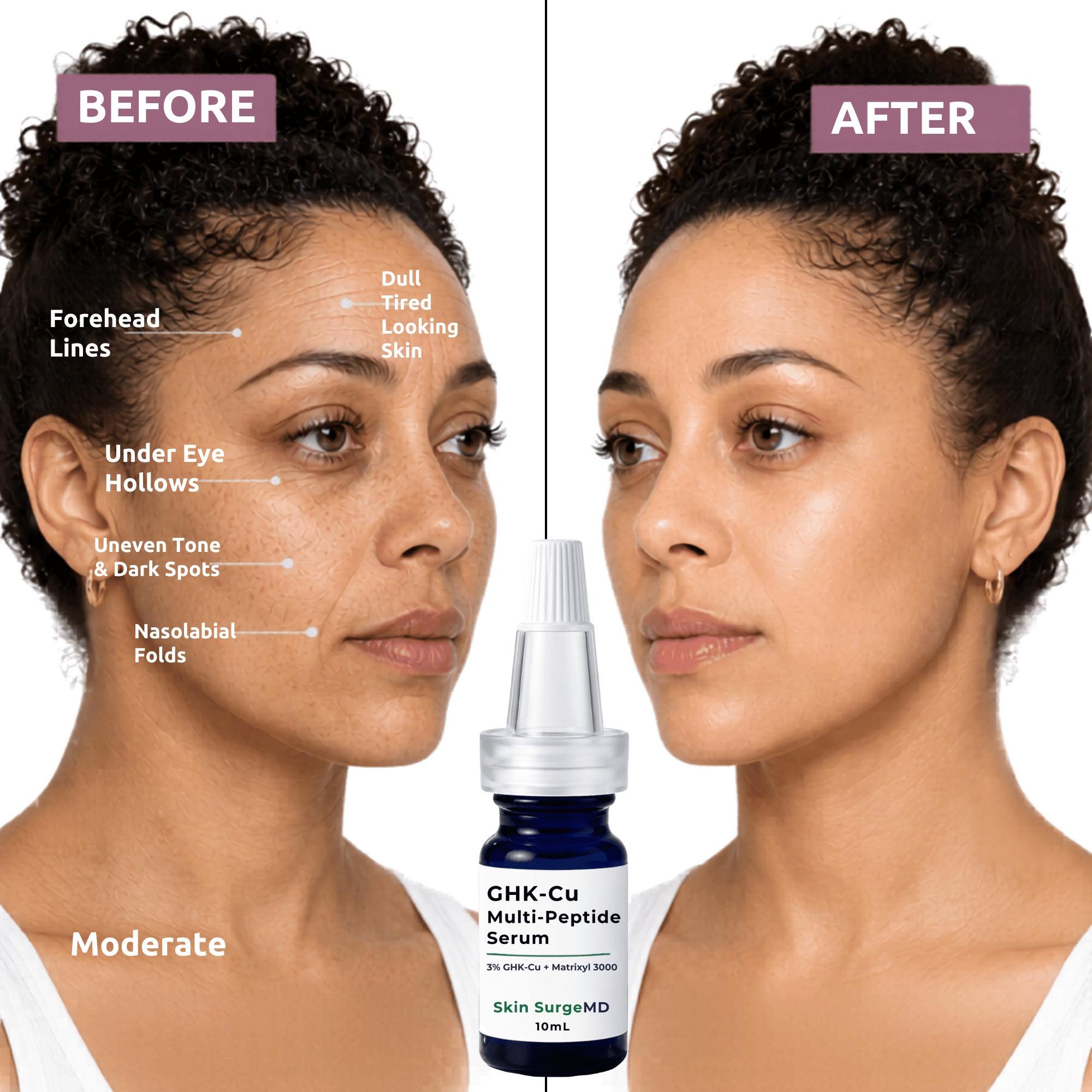 ghk-cu nasolabial folds 2% Serum + EGF, Argireline, Marine Collagen, Vit B5 Buy 5-Amino-1MQ (10mg) - coconut oil Item Volume::1 Fluid Ounce