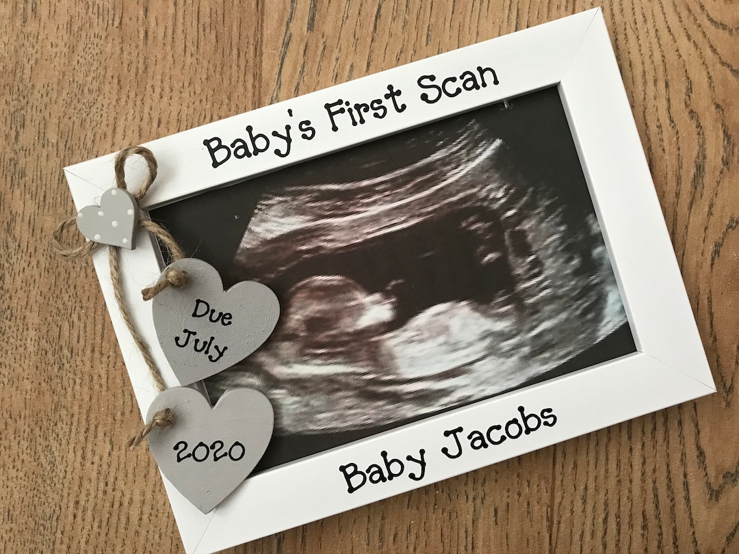 Best way to keep those precious ultrasound photos safe! #babyhacks #ex, ultrasound album