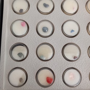 Puede incluir: Una colecci&oacute;n de peque&ntilde;os recipientes redondos y transparentes, cada uno con un esp&eacute;cimen diferente. Los espec&iacute;menes var&iacute;an en color y forma, incluyendo gris, rosa y rojo. Los recipientes est&aacute;n colocados en una bandeja gris.