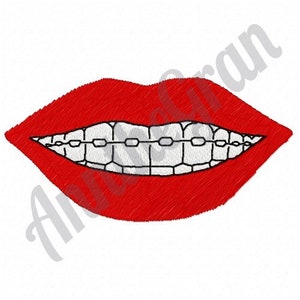 Braces Smile - Machine Embroidery Design. Smiling Woman Lips Embroidery Pattern. Girl Red Lips Embroidery Design