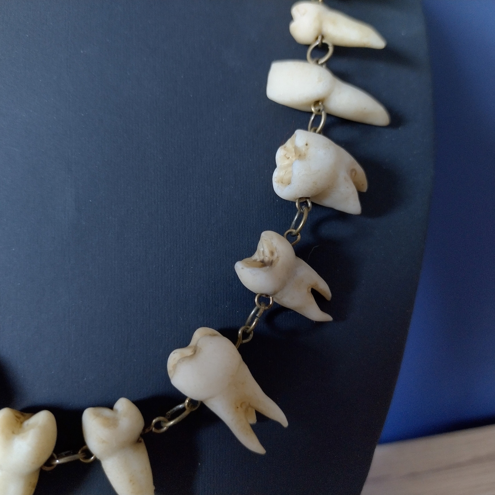 Aged Human Teeth Necklace on Bronze Chain Etsy