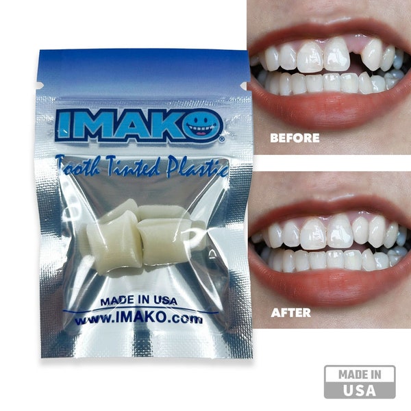 Imako® Tooth Tinted Plastic - Fake Tooth, Chipped Tooth, Gapped Teeth - No Tools Required - Natural Color - Made in USA