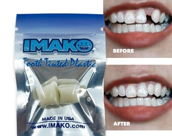 Imako® Tooth Tinted Plastic - Fake Tooth, Chipped Tooth, Gapped Teeth - No Tools Required - Natural Color - Made in USA