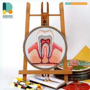Tooth Anatomy Cross Stitch Pattern and Kit: Modern Needlework Art with PDF Pattern and Hoop Art Fun, CS1088