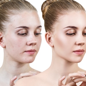 High-End Image Retouching Service, Professional Image Editing Service, Weddings, Boudoir, Portraits, Fashion, Editorial