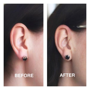 Relief For Damaged, Stretched Earlobes, Help For Heavy Earrings, 5 Pairs image 3