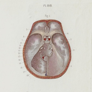 May include: A detailed anatomical illustration of the human eye and surrounding structures. The image shows a cross-section of the eye, with various muscles and nerves labelled. The image is labelled "PL.108." and includes the captions "Fig. 1," "Fig. 2," and "Fig. 3."