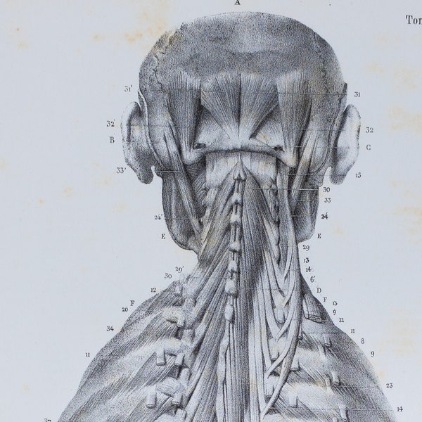 Posterior Trunk Muscle - Fifth Layer - RARE ORIGINAL PRINT from Atlas d'Anatomie descriptive du corps humain C. Bonamy - Paris 1866