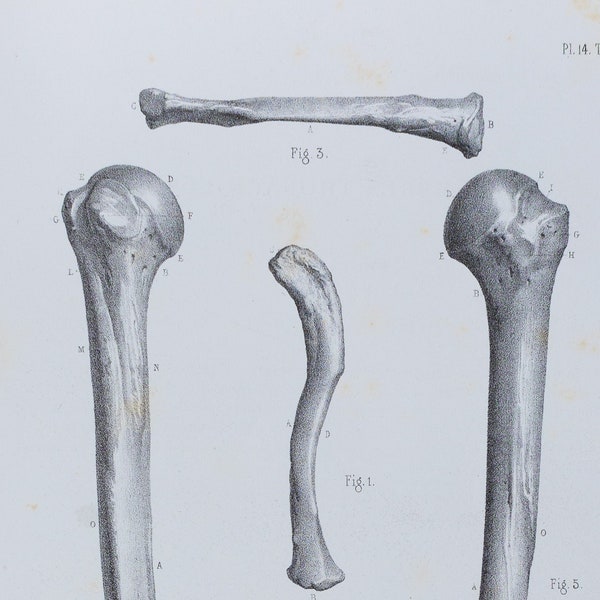 Arm Bones- RARE ORIGINAL PRINT from Atlas d'Anatomie descriptive du corps humain C. Bonamy - Paris 1866